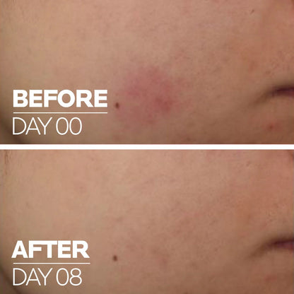 Serum Reparador Cicaplast B5 Concentrado